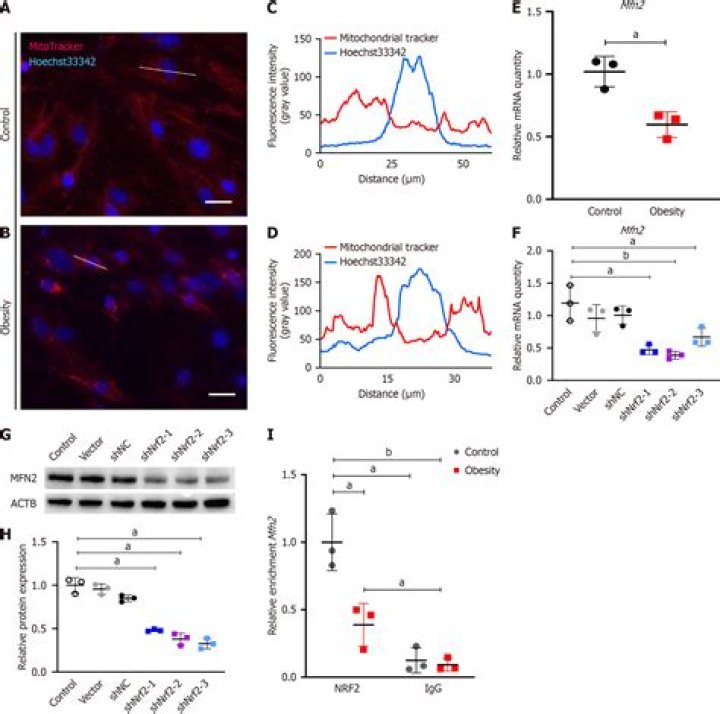 اختر الصيغة التحليلية الصحيحة للعدد ٤٥٢٩٣