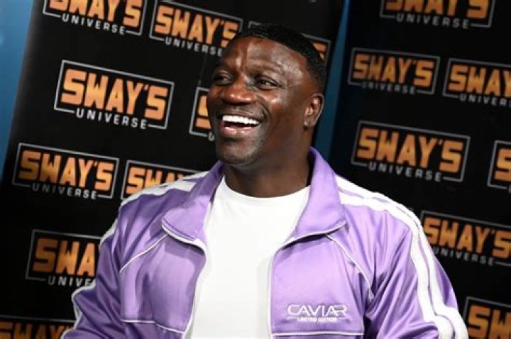 Akon Responds to Memes Making Fun of His Hairline After Transplant Surgery