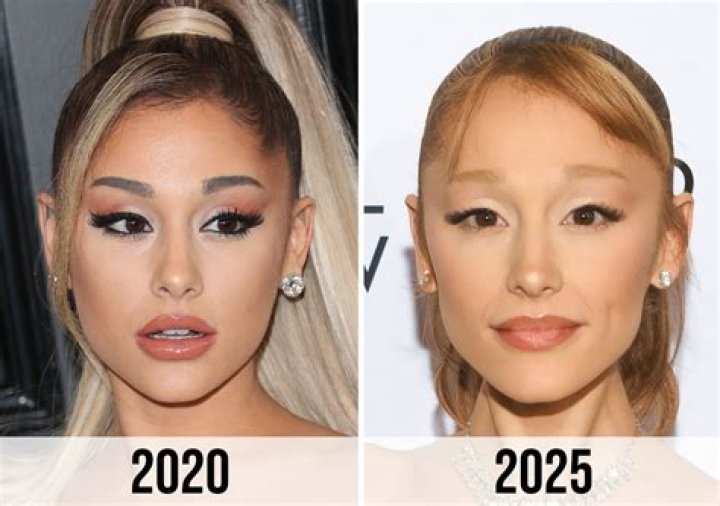 Ariana Grande Opens Up About Having A 'Ton of Filler and Botox' – And The Reason She Stopped