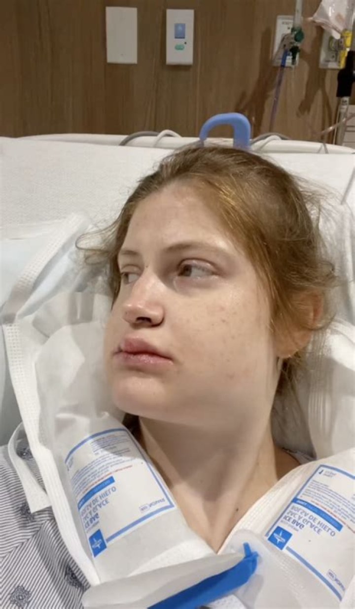 Asuka Wearing Temporary Teeth After Shayna Baszler Kicked Her In The Face