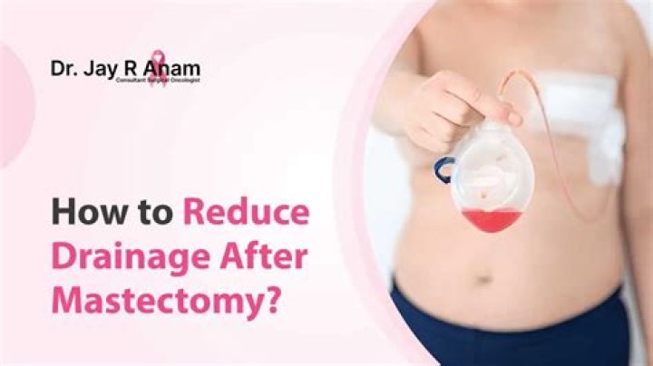 ‘Bachelor’ Alum Lesley Murphy Gets Breast Implants After Double Mastectomy