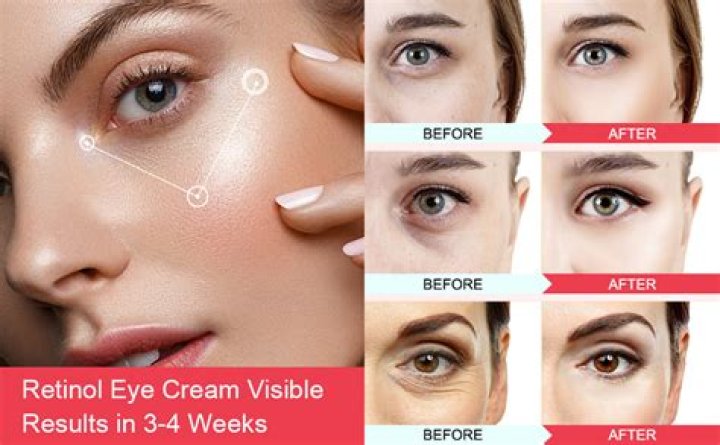 Best Under-Eye Cream for Wrinkles, Aging And More