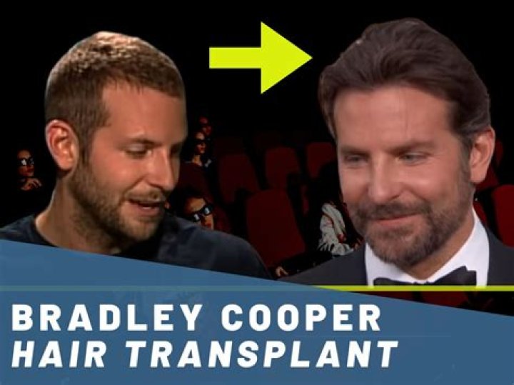 Bradley Cooper's hair trouble – India TV