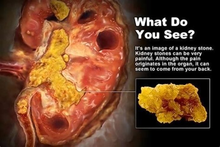 Quick Answer: Can You Die From Too Many Blood Draws