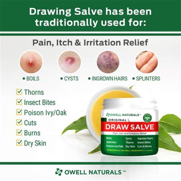 Question: Can You Put Drawing Ointment On A Boil