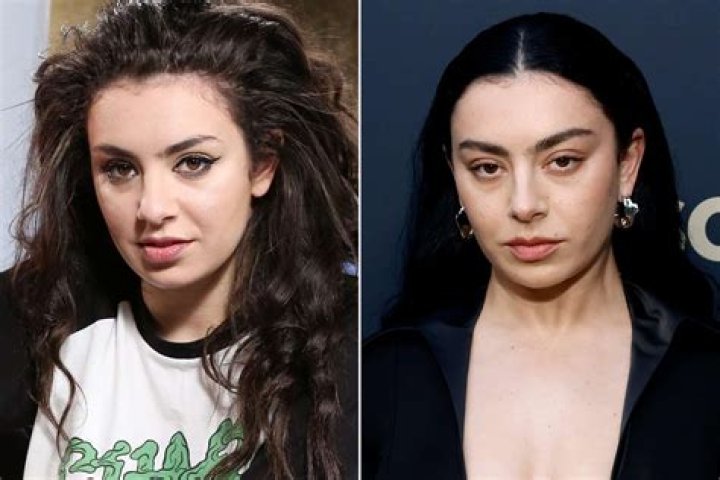 Unveiling The Truth Behind Charli XCX's Nose Job: Fact Or Fiction?