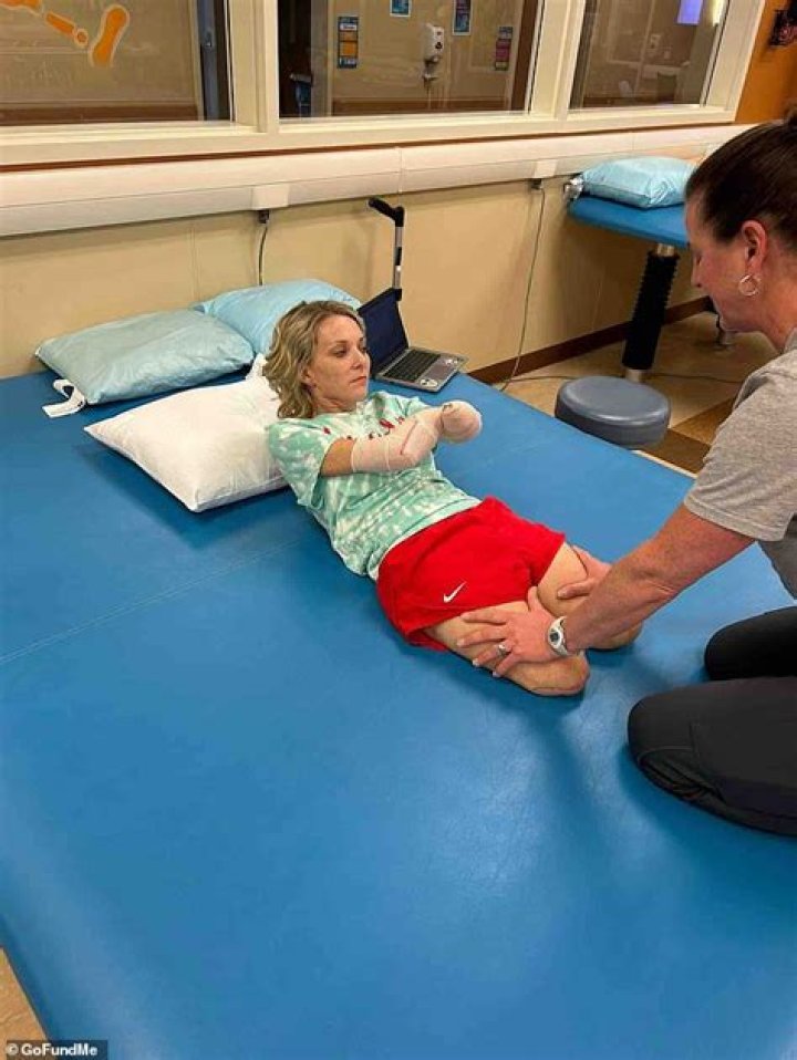 Cindy Mullins: A Journey Of Resilience And Courage As An Amputee