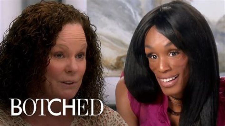 The Most Outrageous Botched Episodes: When Surgery Goes Wrong