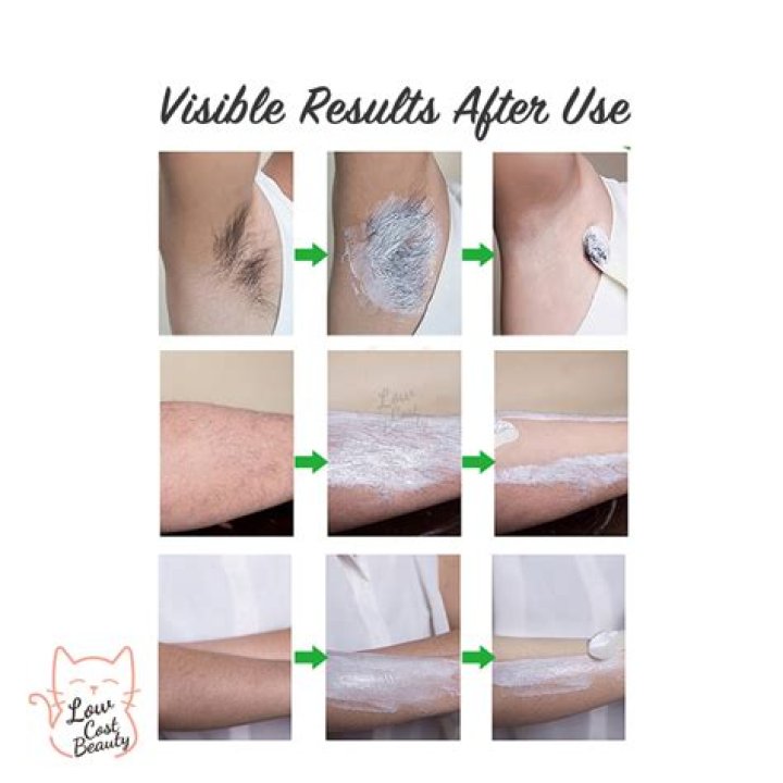 Cream Hair Removal: The Ultimate Guide To Smooth Skin