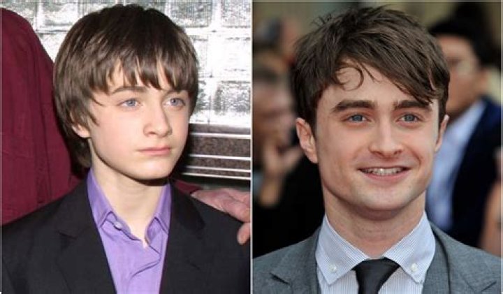 Daniel Radcliffe Age: A Journey Through Time