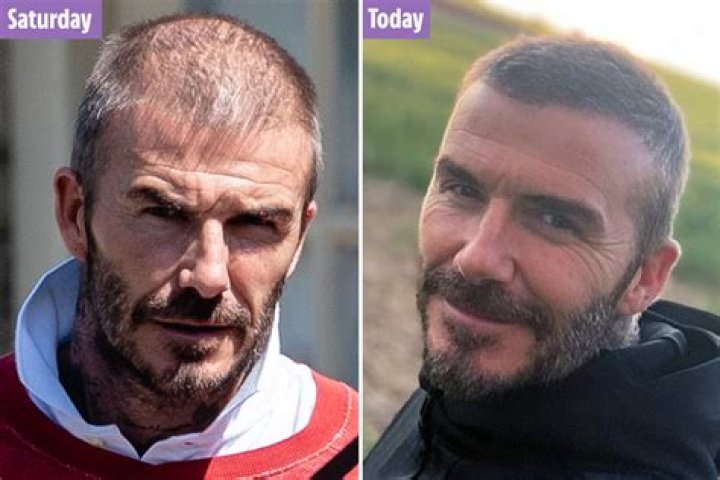 Mystery of David Beckham’s thinning hair as he posts pic with fuller barnet just days after it seemed to be disappearing – The US Sun