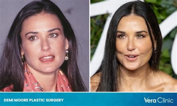 Demi Moore Reveals Where She Hasn't Had Surgery