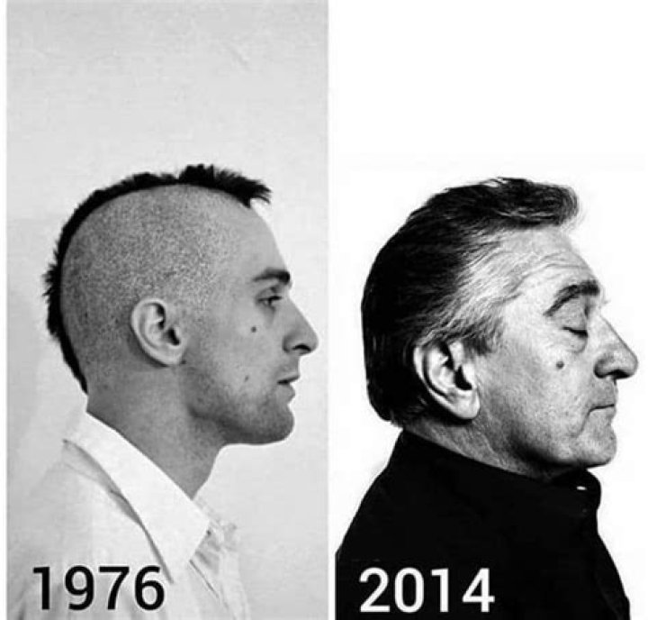 Understanding De Niro Ear: The Unique Trait Of A Hollywood Legend