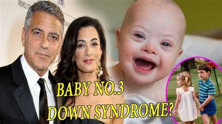 The Truth About George Clooney's Son And Down Syndrome