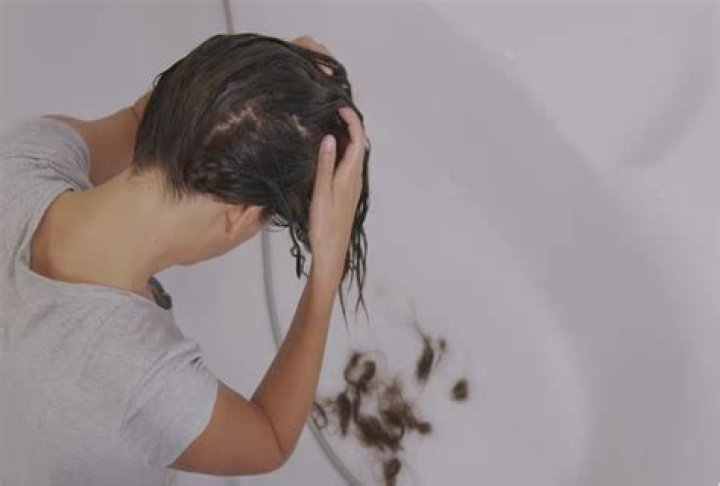 Quick Answer: Does Soft Water Cause Hair Loss