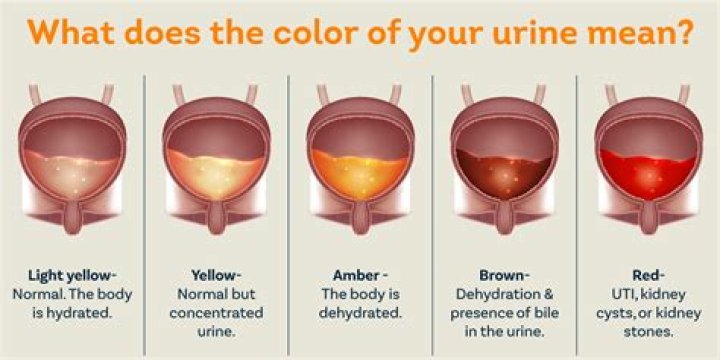 Question: Does Urine Mixed With Bleach Turn Red