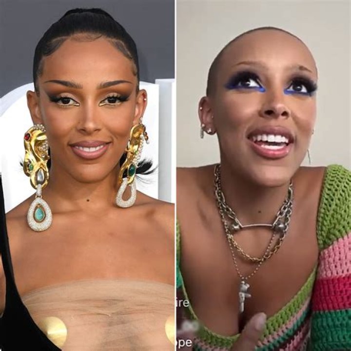 Doja Cat, Amelia Hamlin and More Who Shaved Their Brows: Pics