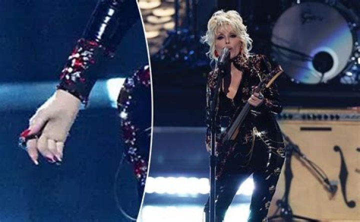 Does Dolly Parton Wear Gloves? Halftime Show Appearance Explained