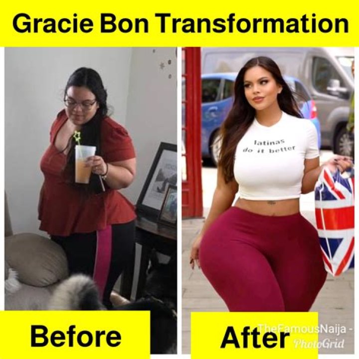 Gracie Bon Before And After Plastic Surgery: A Comprehensive Look