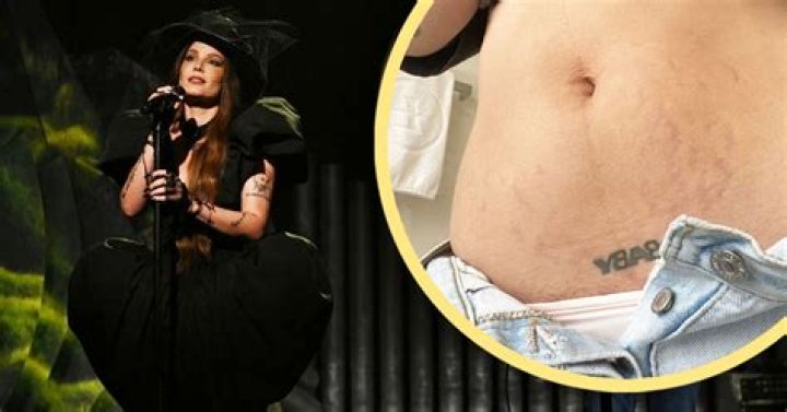 Halsey Shows Off Post-Pregnancy Stretch Marks In An Empowering Post