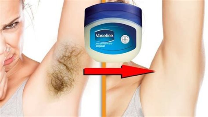 Quick Answer: How Does Vaseline Remove Unwanted Hair