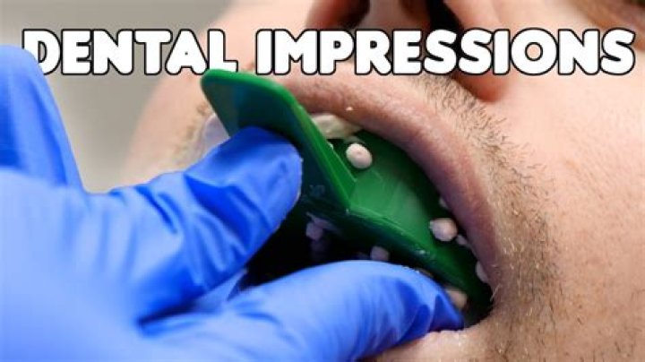 How long do dental impressions take?