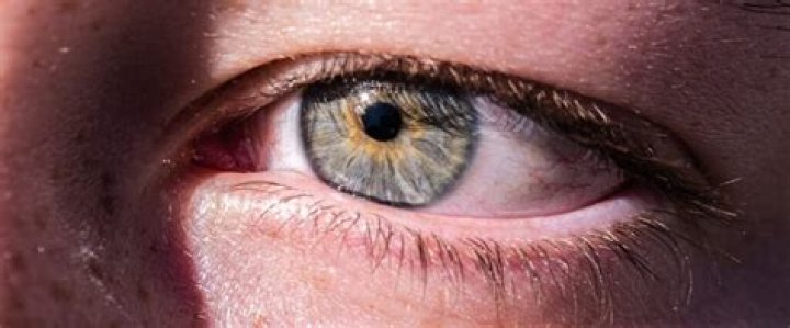 Quick Answer: How Rare Are Yellow Green Eyes