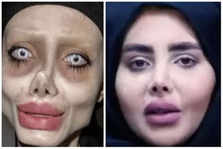 Iran’s ‘Zombie Angelina Jolie’ lookalike on a ventilator with coronavirus she caught when locked up for Instagram antics – The US Sun