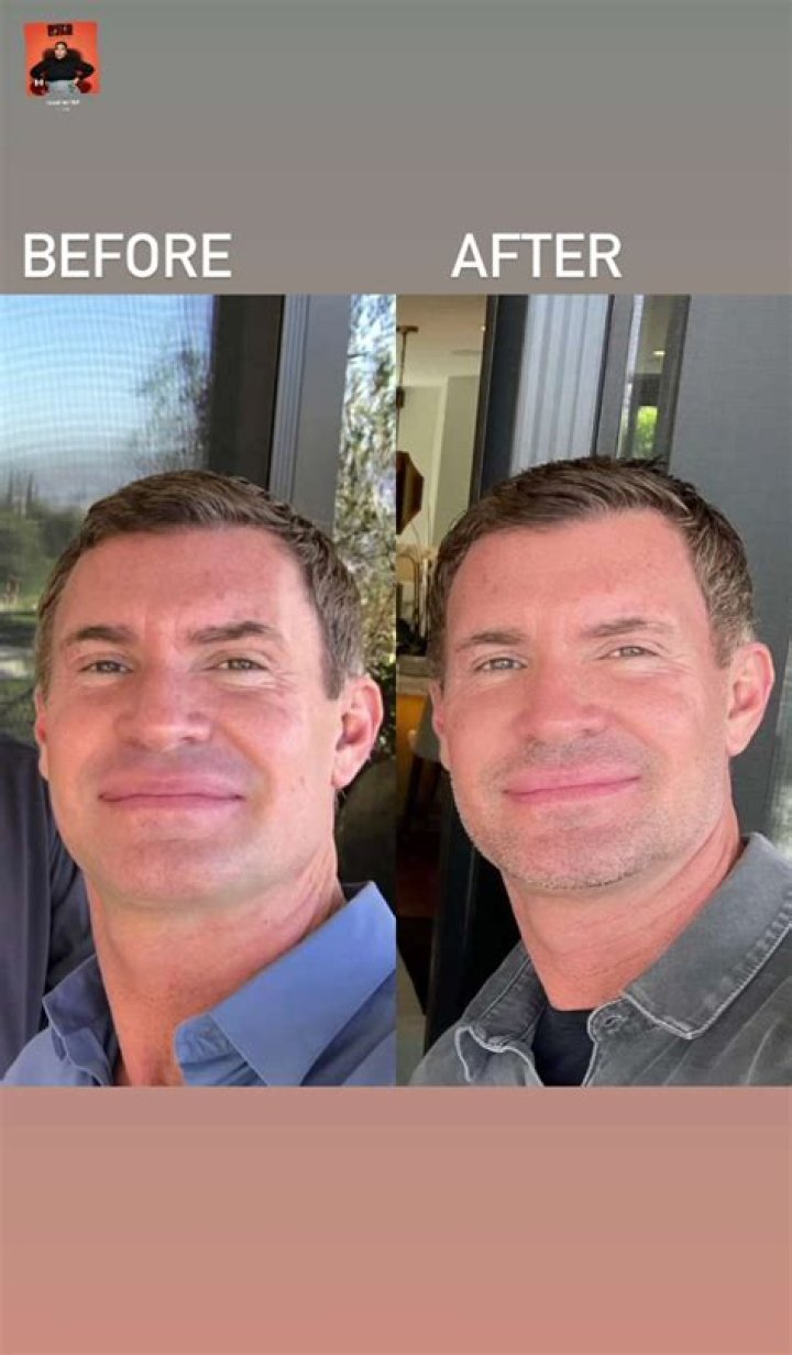 Transformations Unveiled: Jeff Lewis Before And After