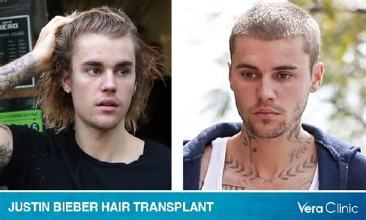 Bieber's Heartbreaking Loss: The Tragic Story Of His Lost Love