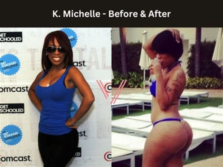 What did K. Michelle look like before and after surgery?