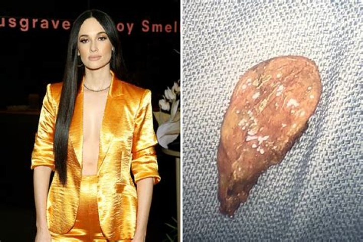 Kacey Musgraves posts snap of her own GALLBLADDER a year after organ surgically removed in 'weird photo' challenge