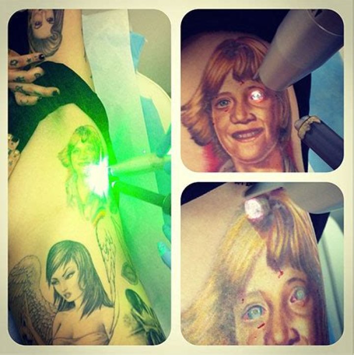 Kat Von D Removing Jesse James Tattoo