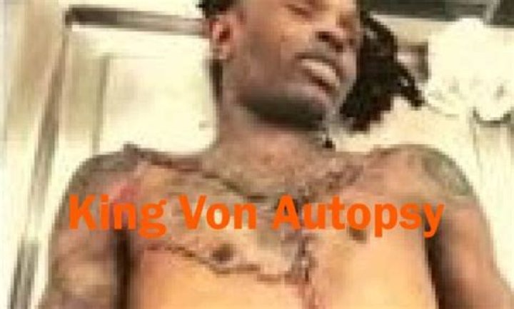 Chilling Images: Autopsy Aftermath Of Slain King Von