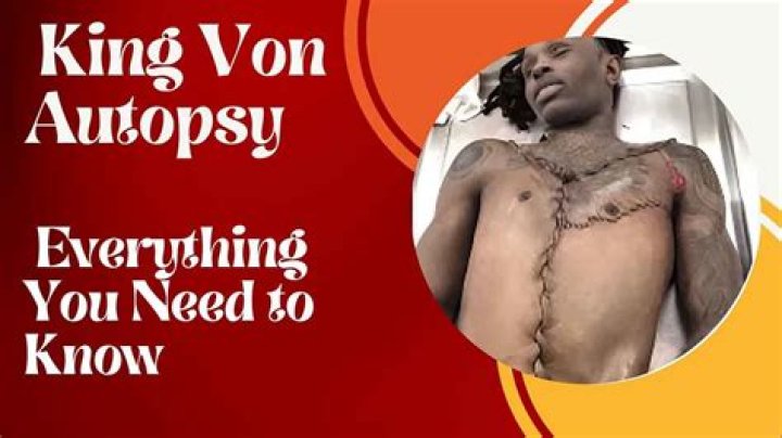 King Von Autopsy Results: An In-Depth Analysis