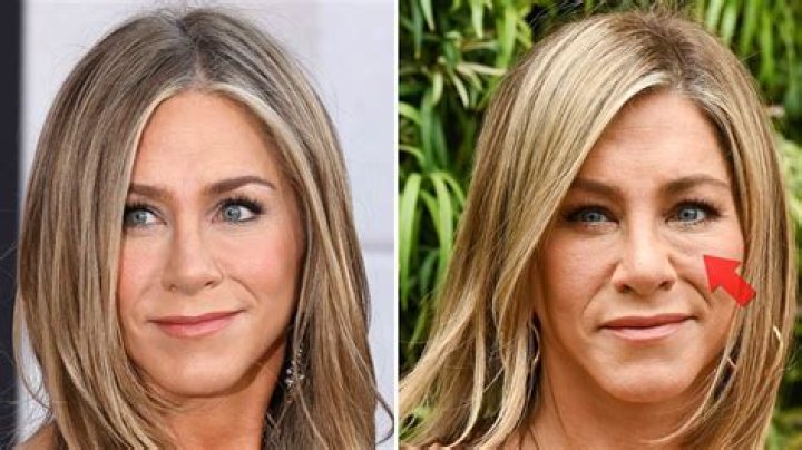 Kris Jenner is 'filler-fatigued in Super Bowl ad & overfilled Jennifer Aniston could copy her tip to avoid puffy face'