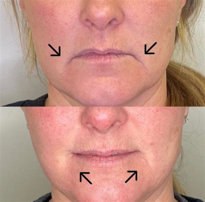 Kristin Cavallari Won't Get Botox, Wants ‘Expression’ in Her Face