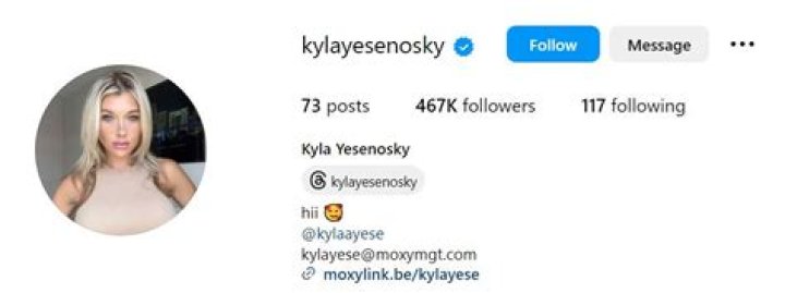 Kyla Yesenosky: The Rising Star In The World Of Social Media