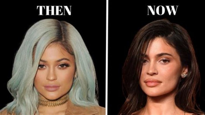 Kylie Jenner: How Her Face Has Changed