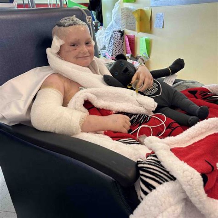 Little boy mauled in face by dog in street and airlifted to hospital