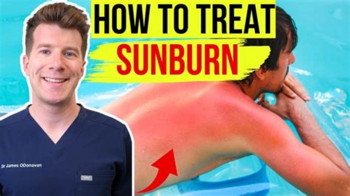 Man screaming ‘Oh my God, I’ve never been in so much pain’ after all-body sunburn is warning to us all