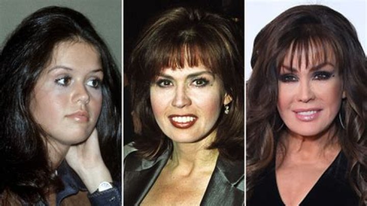 Unveiling Marie Osmond: The Icon Without Her Wig