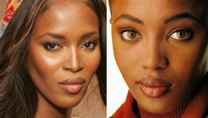 Naomi's Transformation: A Look At Her Nose Before And After