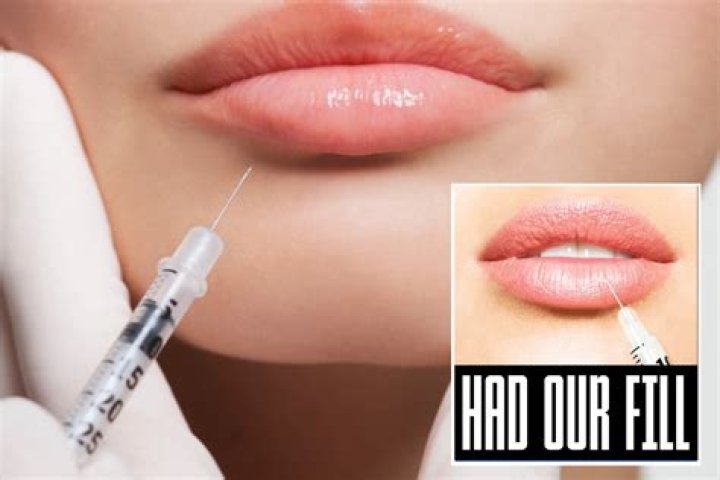 New laws will make it illegal to inject fillers without a licence in win for Sun campaign