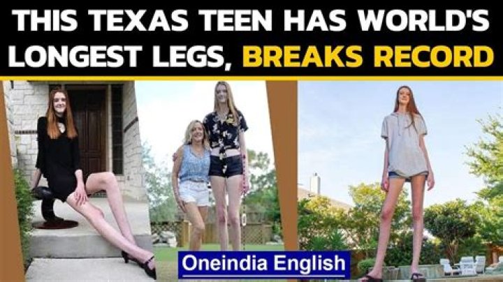 This 6 feet 10 inches tall girl with the longest legs creates a world record – India TV