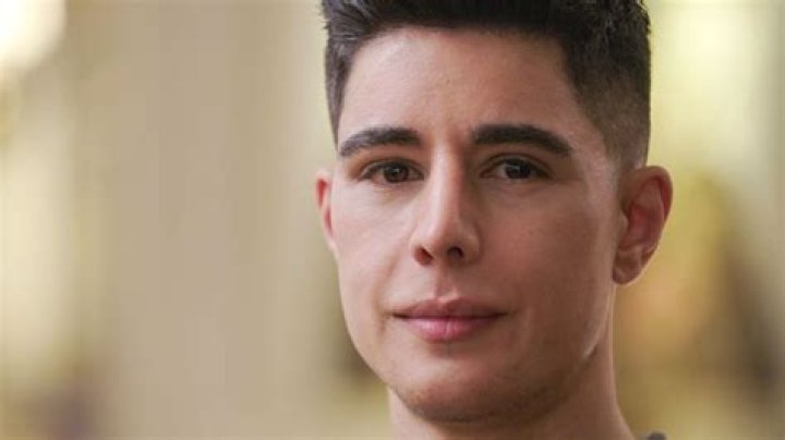 Omid Scobie’s Plastic Surgery: Lets Look His Sexuality, Transformation and More! 2023