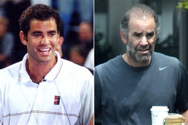 Pete Sampras Age: A Journey Through The Life Of A Tennis Legend