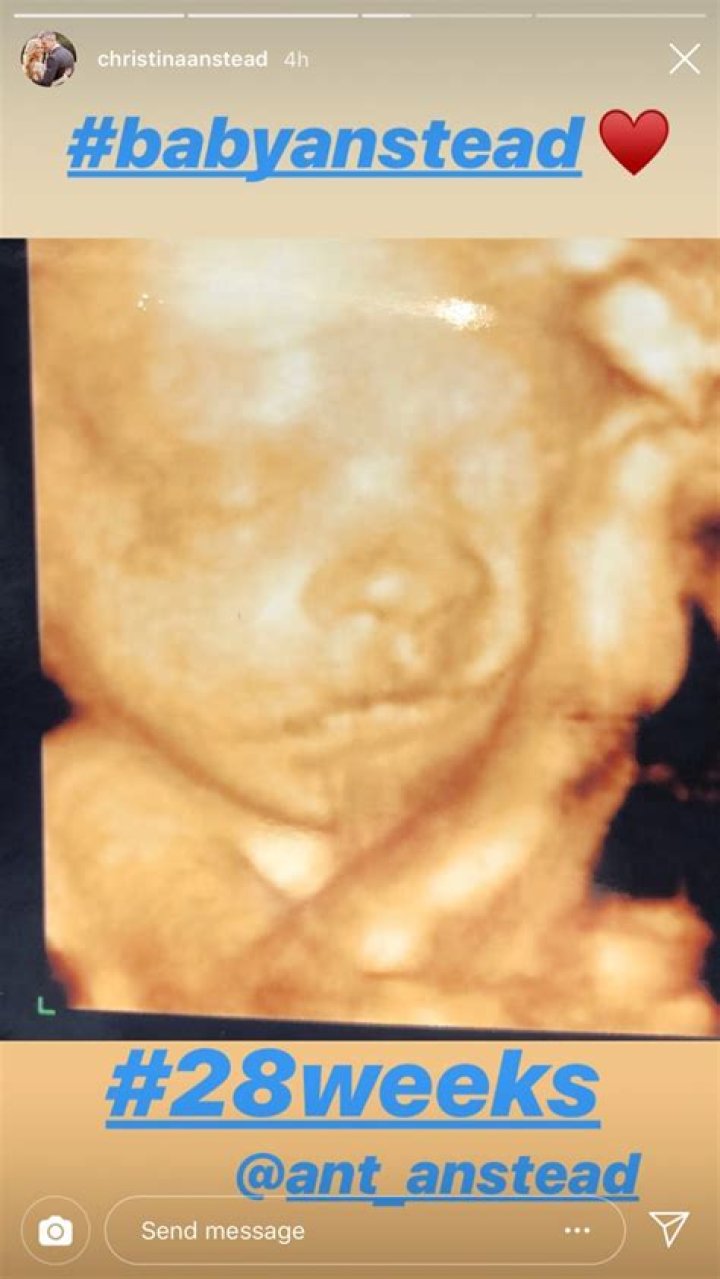 Pregnant Christina Anstead Shares 28-Week Sonogram