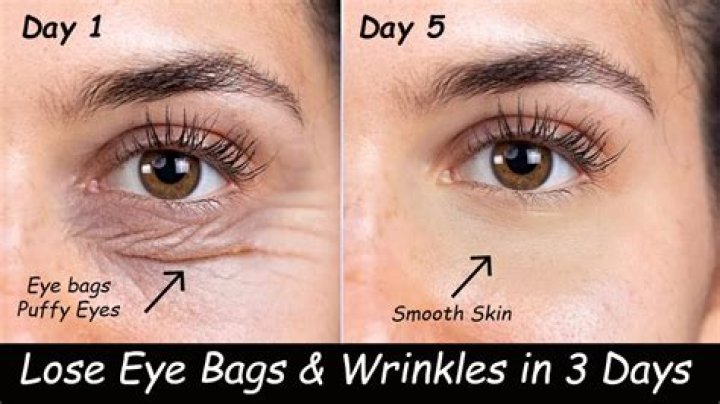 Know amazing benefits of using ghee on the skin – India TV