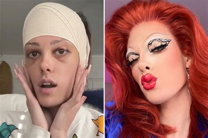 RuPaul's Drag Race star Gigi Goode reveals she’s transitioning and underwent facial feminization surgery